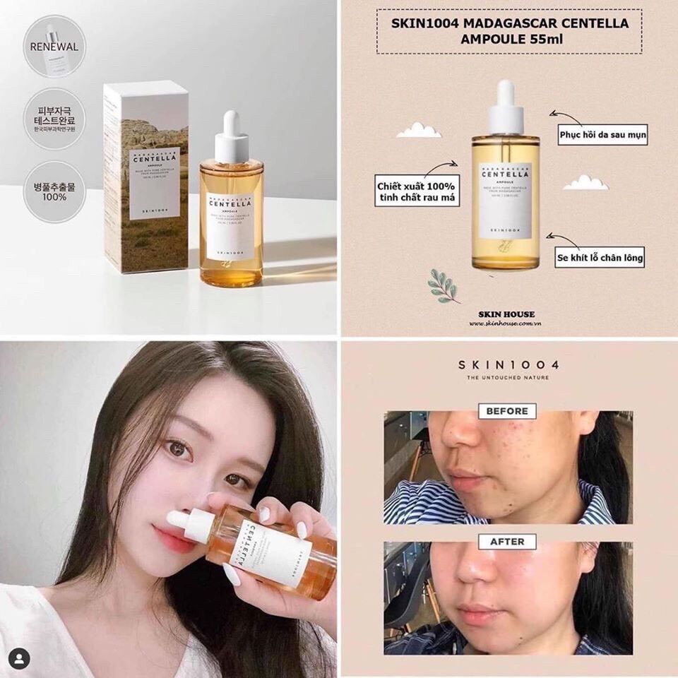 Serum rau má Centella mờ thâm mụn trắng da dành cho da thâm, da mụn 100ml