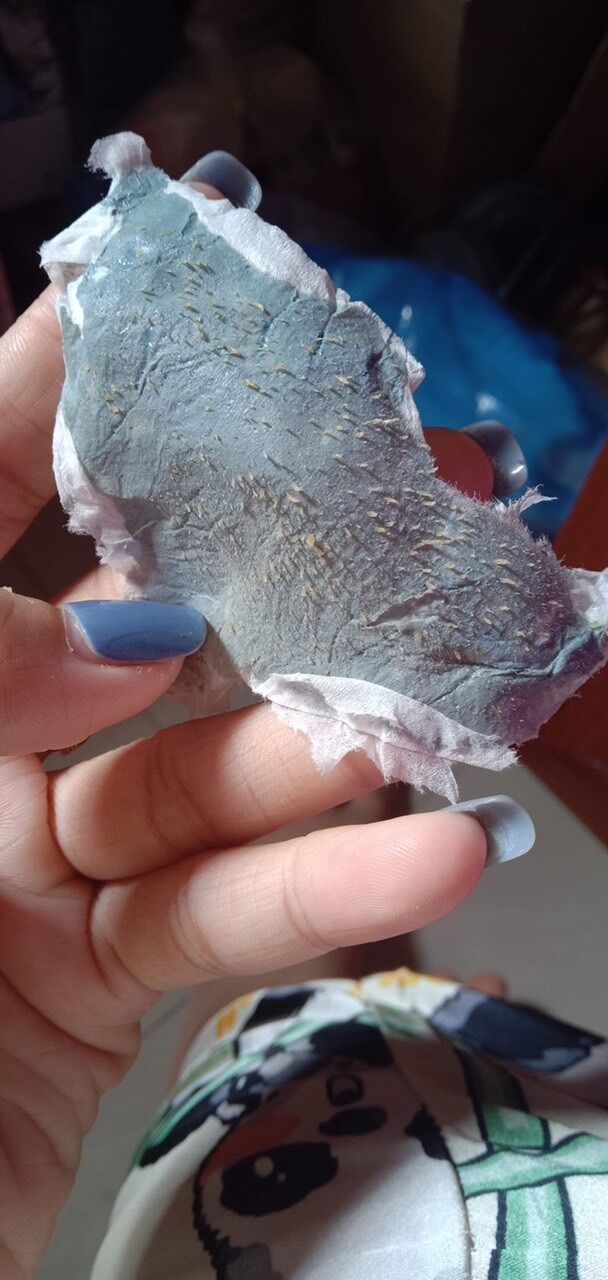 (2 tuyp) gel lột mụn đầu đen mụn cám, se khít lcl