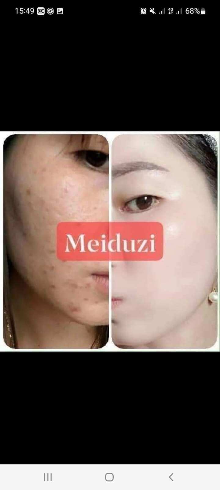 Kem meiduzi nhật bản chính hãng