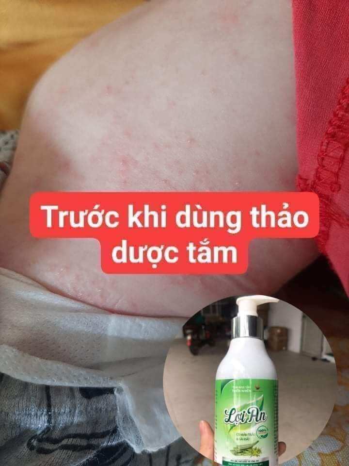 Sữa tắm gội Thảo dược Lợi An
