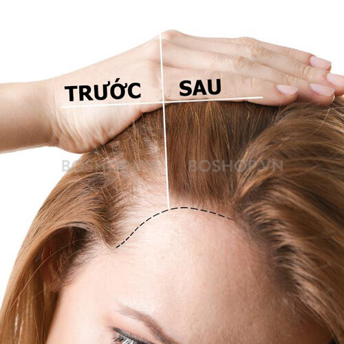 【HCM 】Mọc tóc Sato , mọc tóc Jg Nhật 30ml hàng bệnh viện
