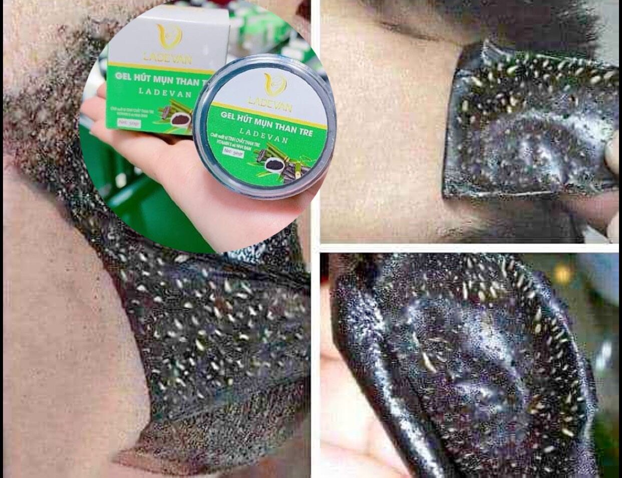 Gel hút mụn than tre hút sạch mụn cám, mụn đầu đen