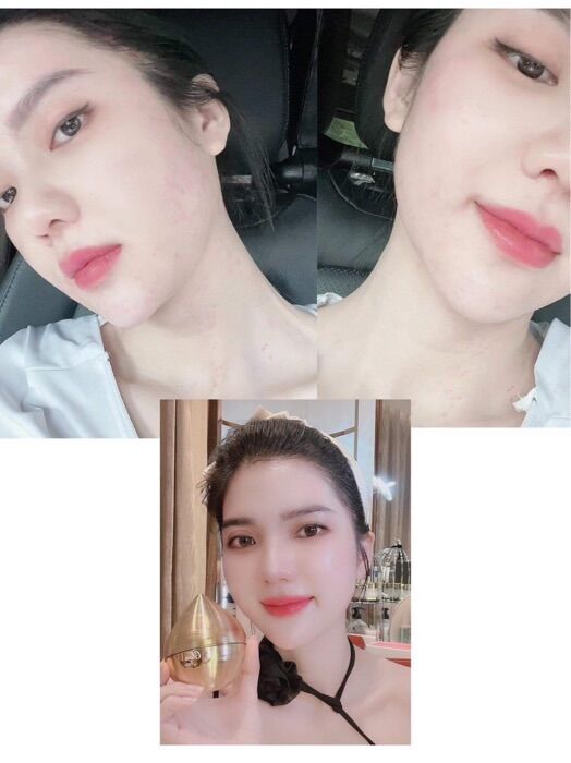 Kem face ủ trắng GLUO FACE WHITENING CREAM ( mwhite )
