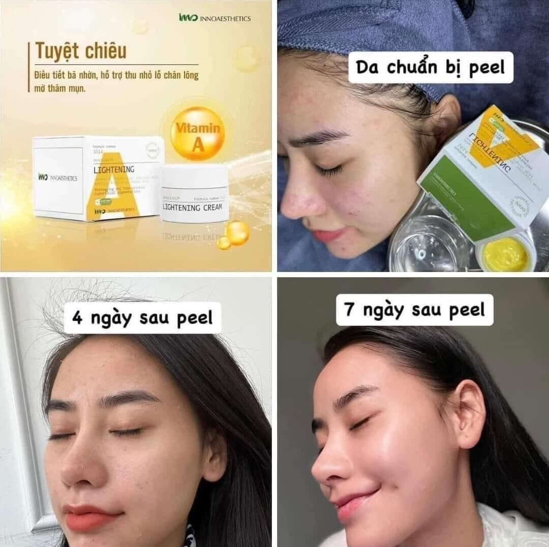 [Lọ Chiet và Fullbox]Thay Da Sinh Học Peel A INNO LIGHTENING CREAM