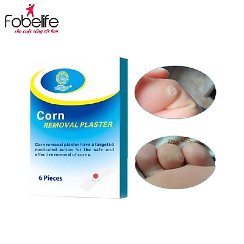 Miếng Dán Mụn Cóc Corn Removal Plaster