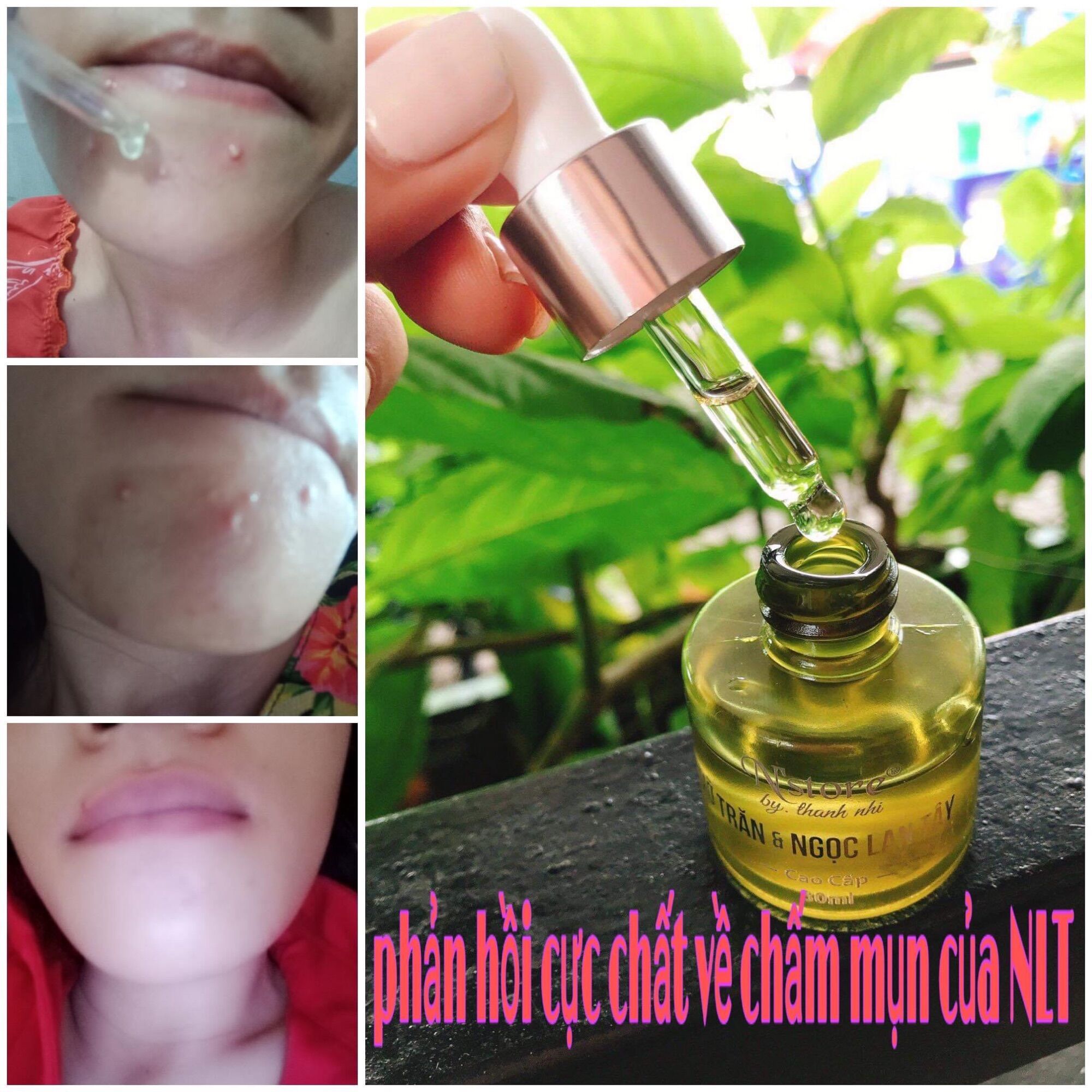Serum Mỡ trăn & Ngọc Lan Tây N’store (triệt lông, dưỡng da, tri m ụ n)