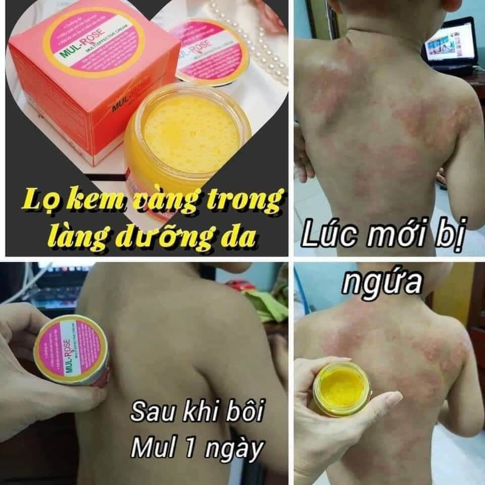 Kem mul Rose đa năng