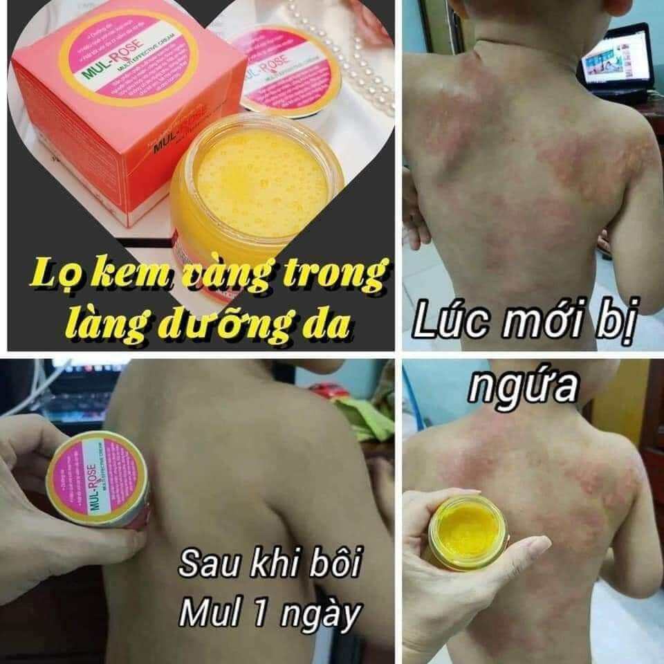 kem mul Rose đa năng