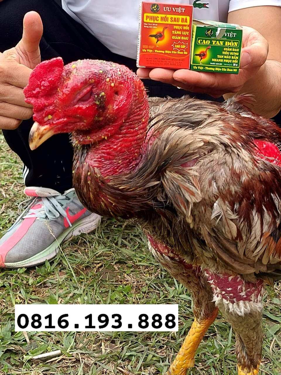 Cao Tan Đòn Ưu Việt+ Tiêm Phục Hồi Ưu Việt