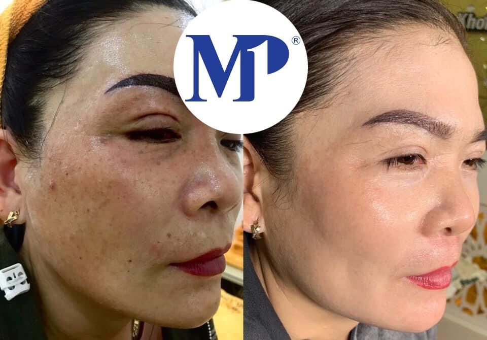 osakura số 2 thuỷ kim luverio